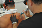 Reversatatt Tattoo Removal Laser Tattoo Removal