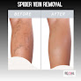 Revival Laser And Skin Clinic Laser Tattoo Removal