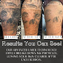 San Antonio Tattoo Removal Co. Laser Tattoo Removal