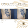 Skin Perfect Medical Aesthetics Laser Tattoo Removal
