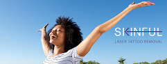 Skinful Tattoo Removal Laser Tattoo Removal