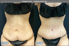 Skinmd Burlington Laser Tattoo Removal