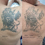 Skn Allegiance Laser Tattoo & Permanent Makeup Removal Laser Tattoo Removal