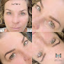 Smart Touch Skin Solutions Laser Tattoo Removal