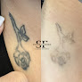 South Florida Laser Studio Laser Tattoo Removal