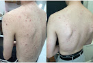 Strella Medical Aesthetics Laser Tattoo Removal