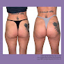 Suddenly Slimmer Med Spa Laser Tattoo Removal