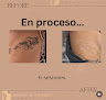 Suntan Pr & Esthetic And Tattoo Removal Laser Tattoo Removal