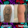 Taketatt Tattoo Removal Laser Tattoo Removal