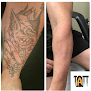 Tatt Cemetery Laser Tattoo Removal