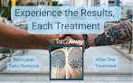 Tatt2Away® Austin Laser Tattoo Removal