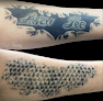 Tatt2Away® Draper Laser Tattoo Removal