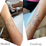 The Brow Shaping Queen Laser Tattoo Removal