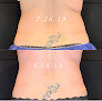 The Sakura Clinic Laser Tattoo Removal