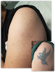 Total Body Laser & Med Spa Laser Tattoo Removal