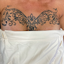 Tropical Sunset Laser & Esthetics Laser Tattoo Removal