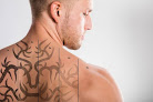 Valley Tattoo Removal Laser Tattoo Removal