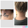 Vanish Laser Aesthetics Laser Tattoo Removal