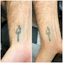 Velvet Tattoo Removal Laser Tattoo Removal