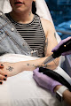 Wifh Laser Tattoo Removal
